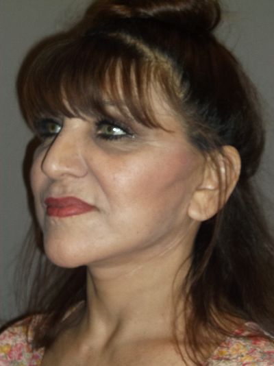 after facelift left angle view of female patient 17