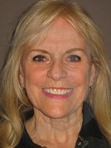 before fractional laser front view of female patient 1051