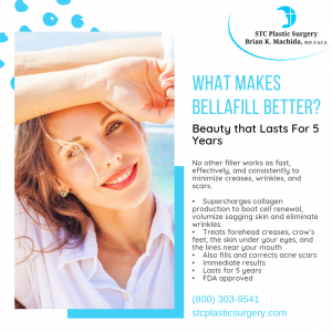 What Makes Bellafill Better? Beauty That Lasts For 5 Years STC Plastic Surgery Ontario, CA